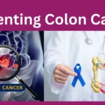 Preventing Colon Cancer