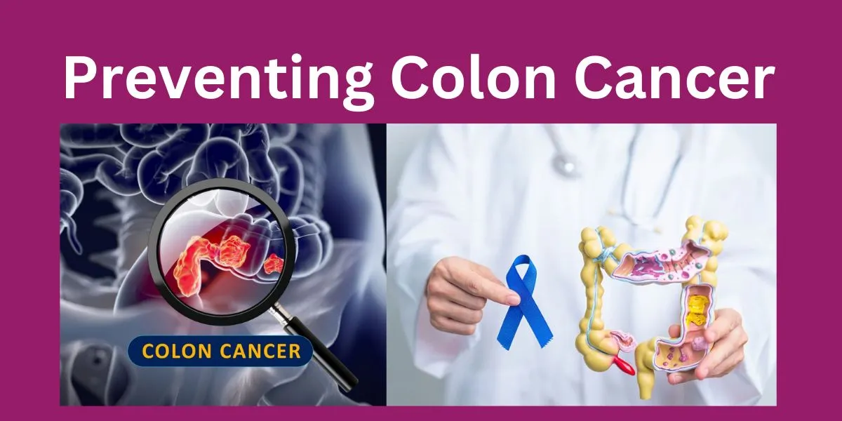 Preventing Colon Cancer